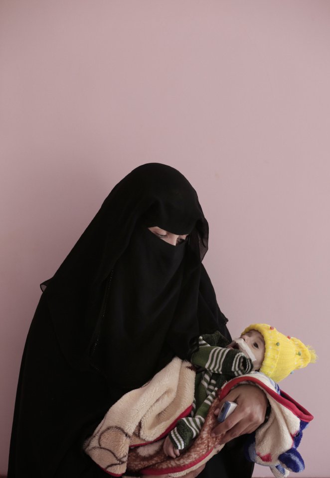 أمهات اليمن .. حزن ومعاناة