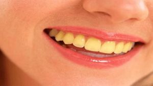 10 أسباب لاصفرار الأسنان