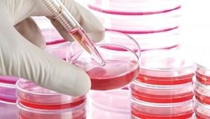 الخلايا الجذعية تظهر نتائج مبشرة في علاج الإكزيما