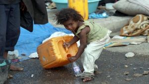 الـ "يونيسف": 370 ألف طفل يمني يعانون من سوء التغذية الحاد