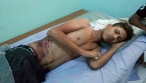 شاب في عدن يتعرض للتعذيب بطريقة وحشية بيد عناصر الامن