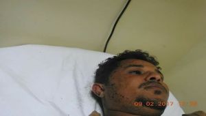 Al-Mawqea Post's reporter has injured in Medi district's frontline