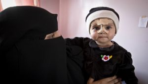 برنامج الأغذية العالمي يطلق صيحة فزع أخرى لتفادي كارثة إنسانية وشيكة في اليمن