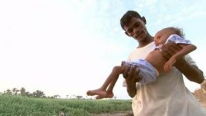 الأمم المتحدة: اليمن يواجه أحد أسوأ أزمات الجوع في العالم