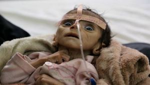 اليمن ودول أفريقية.. مربع تهدده المجاعة والنزاعات المسلحة