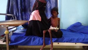 الكونغرس يُعيد التصويت على مشروع قانون لإنهاء الدعم الأمريكي للسعودية في حرب اليمن