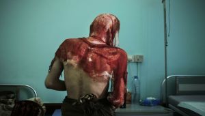 Beaten, burned: Yemeni medic recalls abuse in rebels’ prison