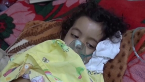 تدشين حملة تطعيم ضد الحصبة تستهدف 13 مليون طفل يمني