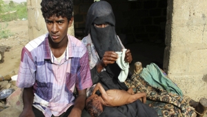 شركة أسلحة بريطانية تحتفل بأرباحها مع تجويع وقتل اليمن (ترجمة خاصة)