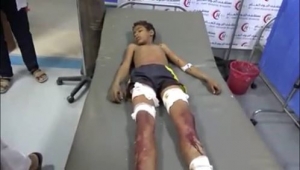 مقتل طفل وإصابة شقيقه بانفجار مقذوف في الحديدة