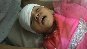 إصابة خمسة أطفال في قصف حوثي استهدف حيا سكنيا بتعز