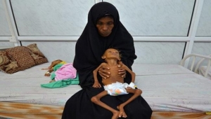 جماعة الحوثي: وفاة 100 ألف طفل يمني سنويا بسبب الحرب والحصار