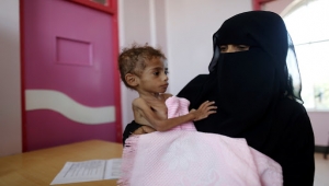 برنامج أممي: نصف أطفال اليمن يعانون سوء التغذية المزمن
