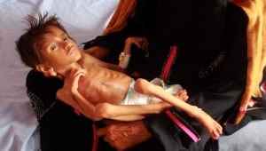 تدهور الوضع المعيشي في اليمن يهدد بمجاعة غير مسبوقة (تقرير)
