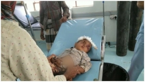 إصابة طفلين في تعز والحديدة بقذائف حوثية