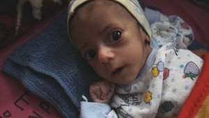 الحرب في اليمن: مدينة مأرب تعيش مأساة إنسانية في ظل "حرب قذرة"