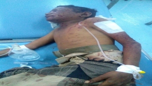 إصابة طفل بانفجار لغم زرعه الحوثيون غربي تعز