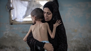 "حكومة غزة": 1.2 مليون طفل بالقطاع يعانون انعدام أمن غذائي حاد