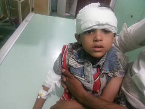 مليشيا الحوثي ترتكب مجزرة مروعة في تعز معظم ضحاياها من الأطفال (صور)