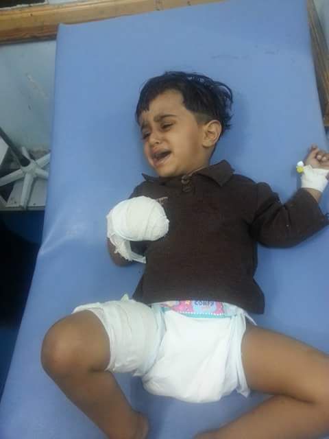 مليشيا الحوثي ترتكب مجزرة مروعة في تعز معظم ضحاياها من الأطفال (صور)