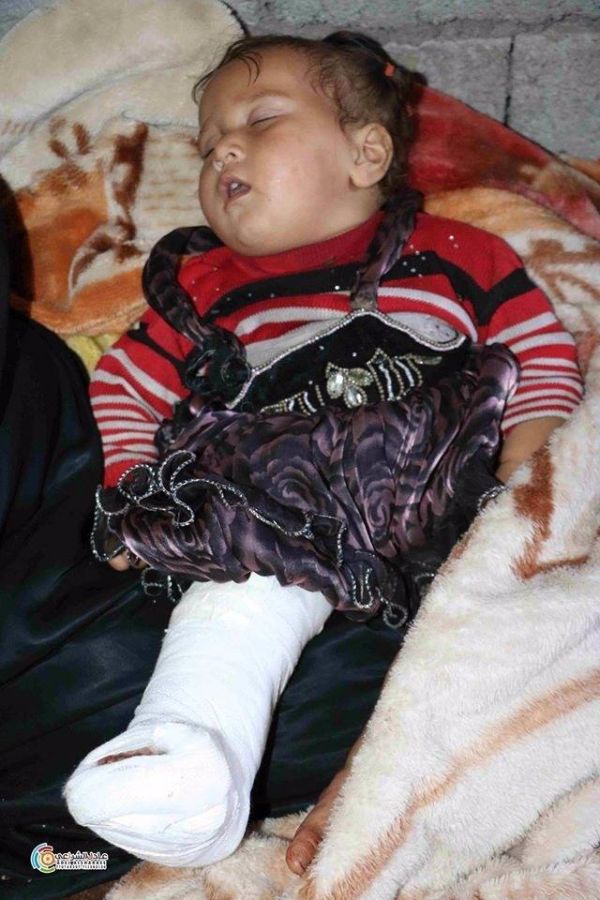 إب : إصابة طفلة نازحة بطلق ناري في ظل فلتان أمني كبير تشهده المحافظة