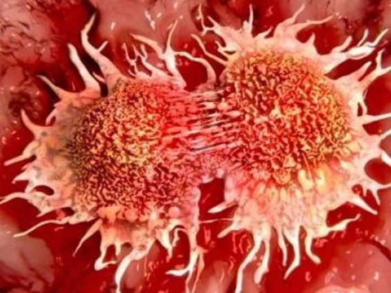 علماء يطورون وسيلة حديثة لقتل خلايا السرطان (فيديو)