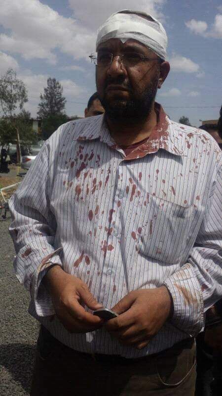 مليشيا الحوثي تعتدي بالضرب على أحد أساتذة كلية الإعلام بجامعة صنعاء