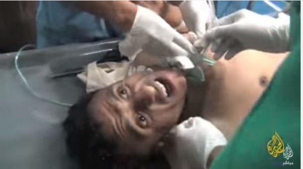 بالفيديو ..جريح من المقاومة اليمنية يصرخ: 