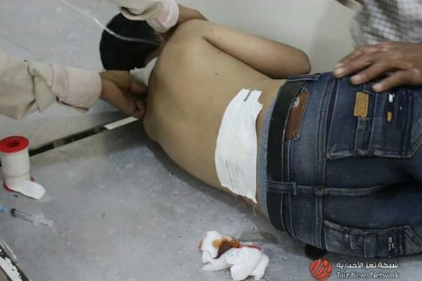 إصابات من المدنيين بقصف مستمر للمليشيا على الأحياء السكنية بتعز (صور)