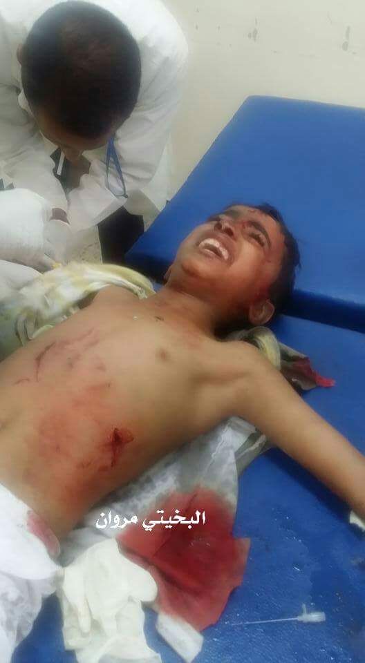 مليشيا الحوثي ترتكب مجزرة بشعة بحق المدنيين في تعز (صور)