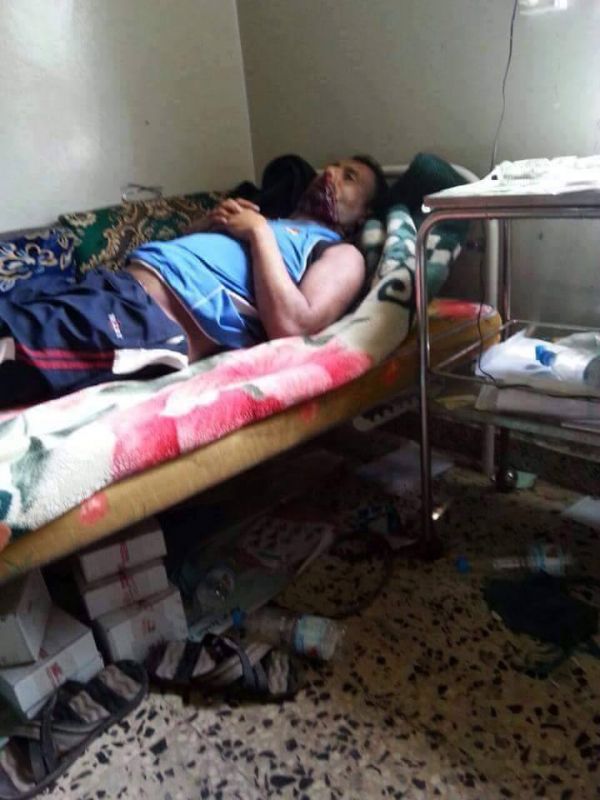 إب: العثور على جثة مدير مستشفى حكومي ببعدان مقتولاً في ظروف غامضة