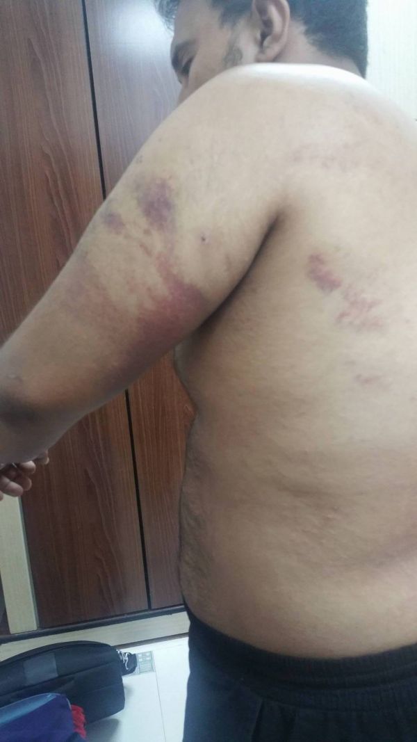 نجل قيادي إصلاحي يروي لـ (الموقع بوست) تفاصيل اعتقاله وتعذيبه من قبل الحزام الأمني في عدن