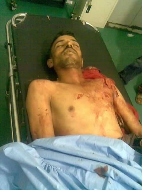 إب: توتر أمني بعد إصابة مواطن برصاص الحوثيين والعثور على جثة آخر مقتول بمديرية السبرة
