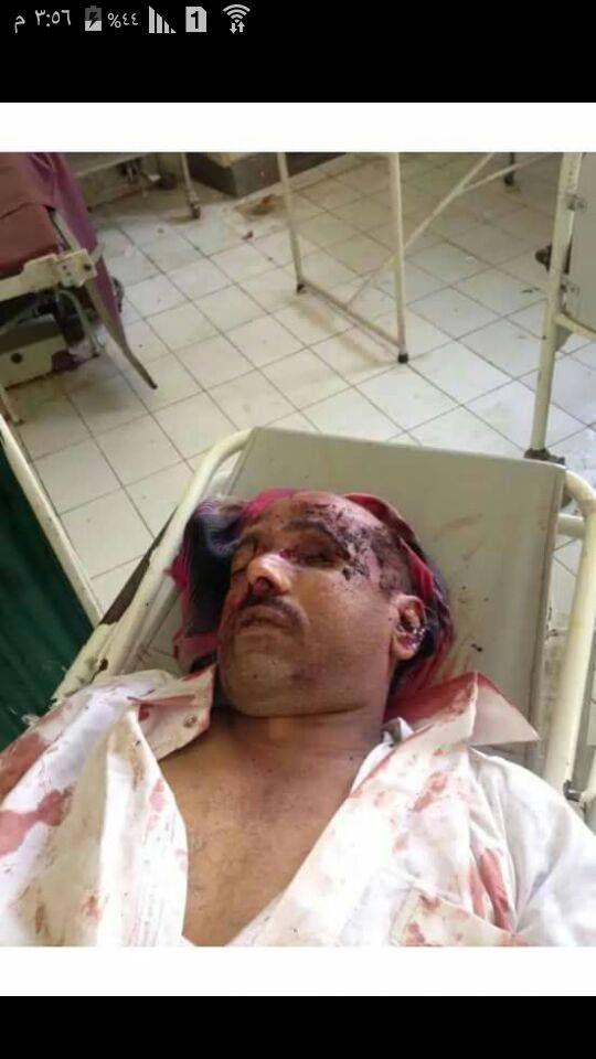 مقتل رئيس اللجان الثورية في مليشيا الحوثي بمديرية النادرة شمال شرق محافظة إب ( صورة)