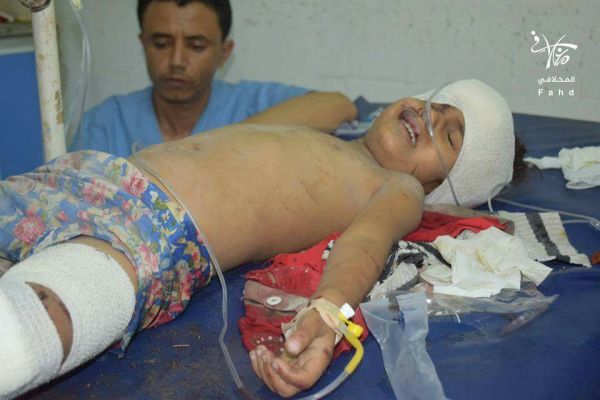 جريمة جديدة لمليشيا الحوثي والمخلوع بحق المدنيين في تعز (صور)