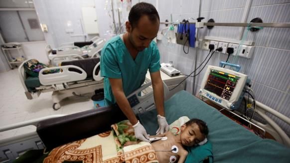 ارتفاع معدلات سوء التغذية الحاد يهدد أطفال اليمن