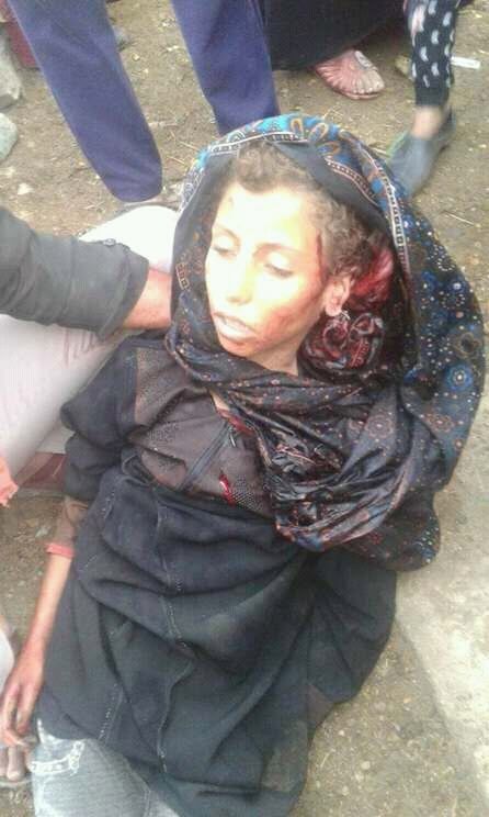 مقتل طفلة برصاص قناص حوثي في الشقب جنوب تعز