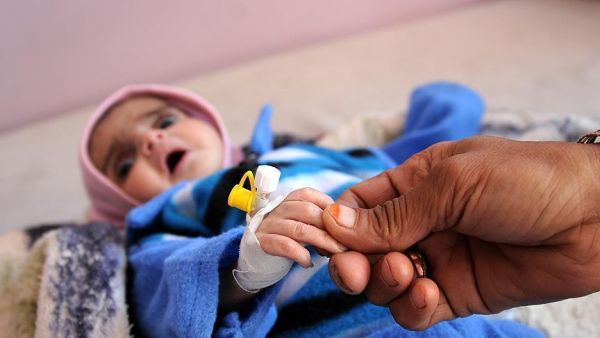 الكوليرا.. قاتل إضافي في اليمن المنهك