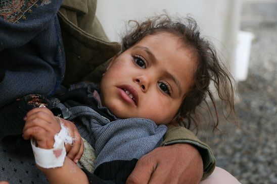 اليونيسيف تٌرجح وصول عدد الحالات المصابة بالكوليرا في اليمن إلى 130 ألف حالة خلال أسبوعين