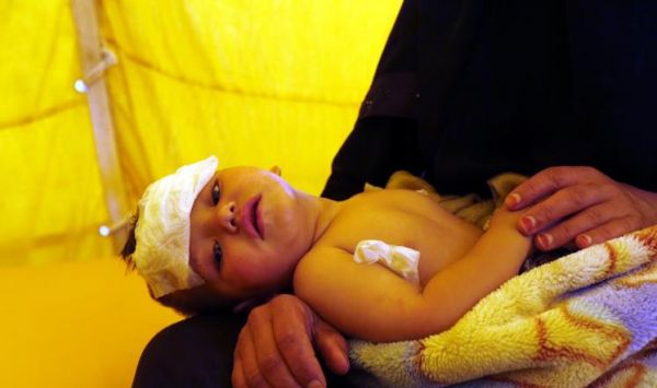 باحثون غربيون يتهمون أمريكا وبريطانيا بالوقوف خلف انتشار الكوليرا في اليمن