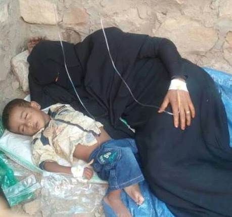 ارتفاع وفيات الكوليرا في اليمن إلى 2016 حالة