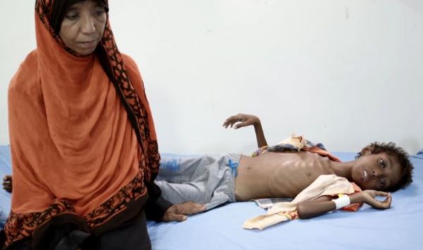 الصحة العالمية تخطط لحرب على الكوليرا باليمن