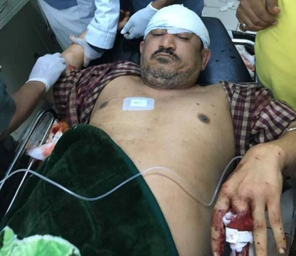 مسلحون يهاجمون منزل القيادي في مقاومة عدن أديب العيسي ويصيبونه بجروح خطرة