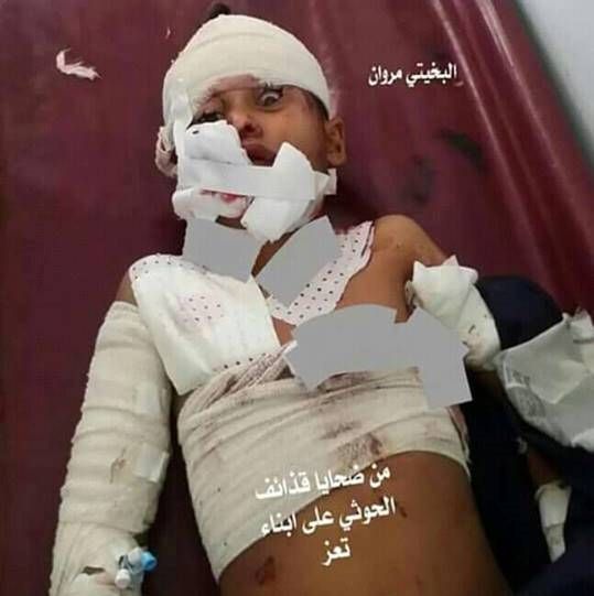 إصابة طفلين جراء قصف الحوثيين الأحياء السكنية بتعز