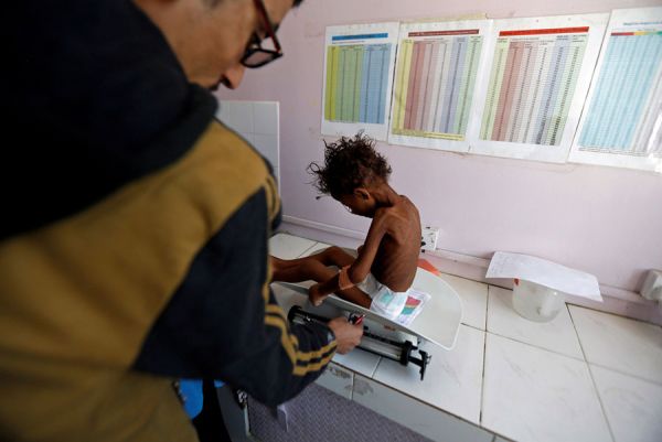 الأمم المتحدة: 30 ألف حالة سرطان جديدة كل عام في اليمن و214 نقطة تفتيش تعيقنا من التحرك