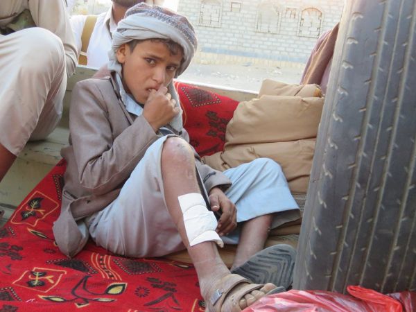 مأرب.. طفل مجند بصفوف الحوثيين يقع أسيرا بيد الجيش الوطني بصرواح (صورة)