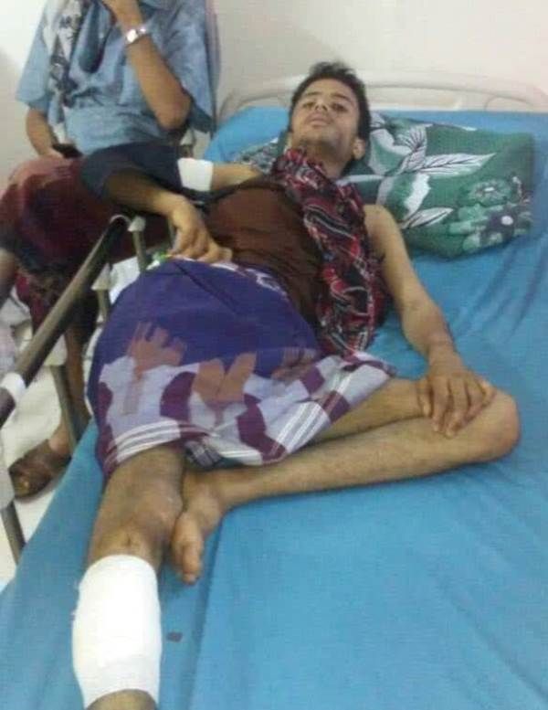 إصابة مدني في قصف لمسلحي الحوثي على قرى غرب مريس