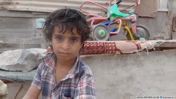 6 آلاف مريض بالجوع في صنعاء