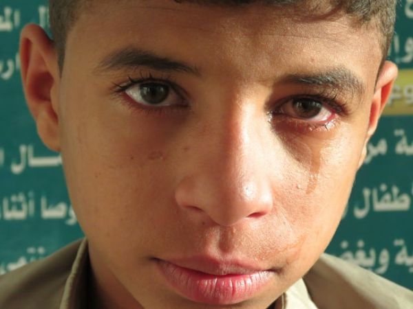 طفل يحكي بألم قصة اعتداء الحوثيين على والدته وأخذه بالقوة إلى جبهات القتال