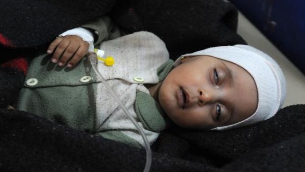 256 حالة مشتبه بإصابتها بالكوليرا في صنعاء